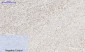 HIF-1α Polyclonal Antibody